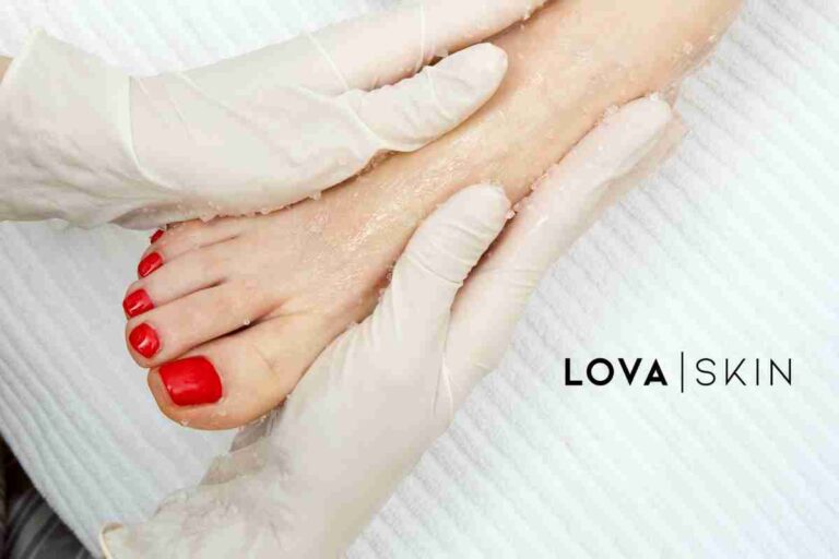 Peeling pieds Lovaskin